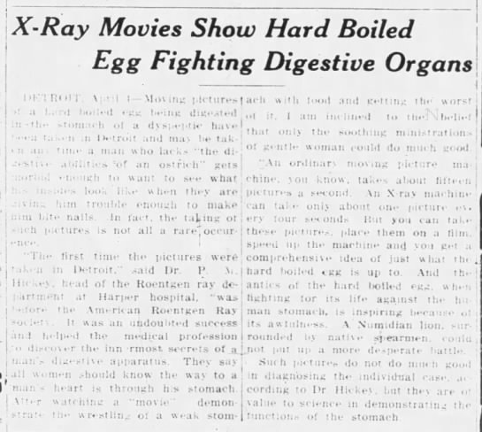 X-ray movies show hard boiled egg fighting digestive organs (1913) - 