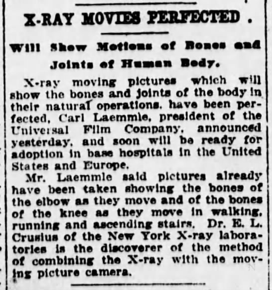 X-ray movies perfected. Will show motions of bones and joints of human body. (1918) - 