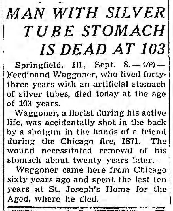 Ferdinand Waggoner -Man With Silver Tube Stomach Is Dead at 103