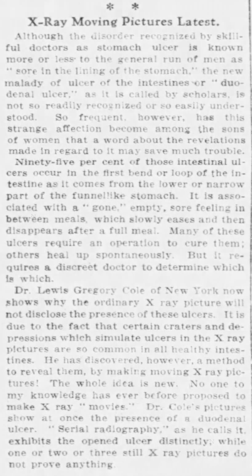X-ray moving pictures latest (1913)